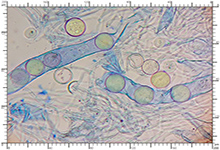 Hydnocystis bombycina